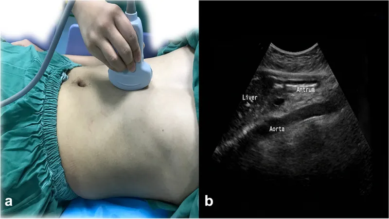 Gastric ultrasound sagittal view: probe position & anatomy