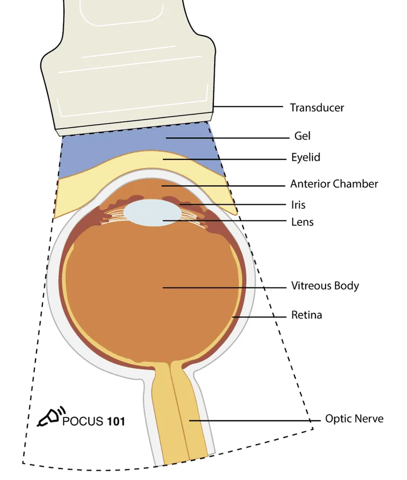 Ocular Ultrasound: Normal Anatomy Labeled Diagram