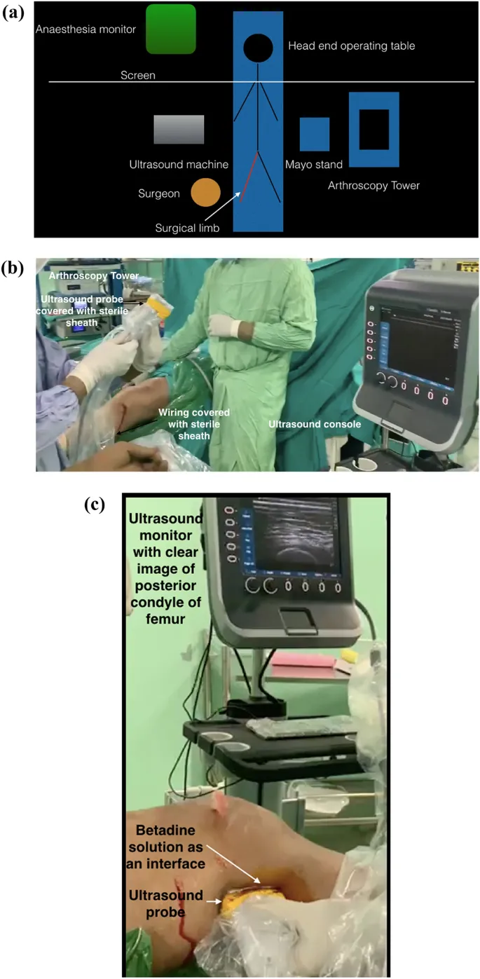 Ultrasound setup for regional anesthesia