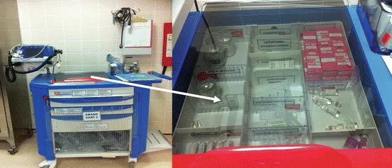 PACU setup with monitors and emergency equipment