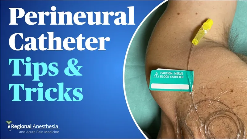 Perineural Catheter Placement
