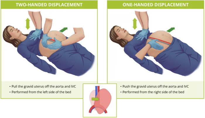 Manual uterine displacement techniques