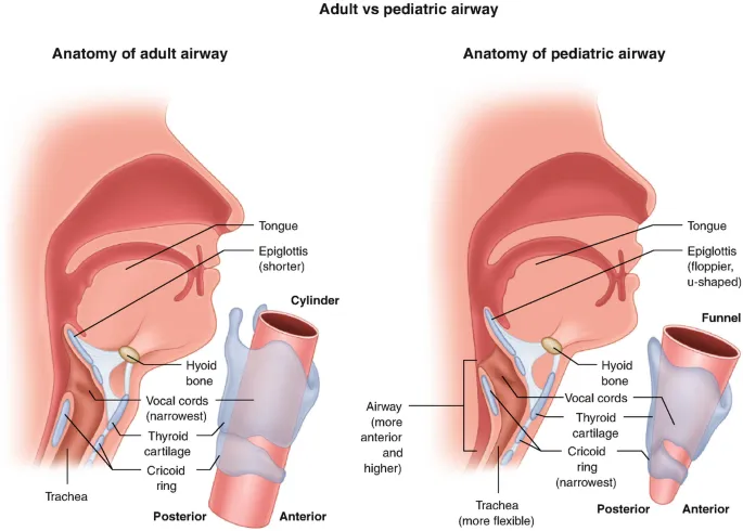 Adult vs Pediatric Airway Anatomy Comparison