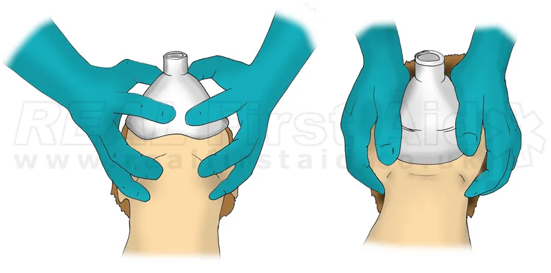 Mask ventilation: E-C clamp technique