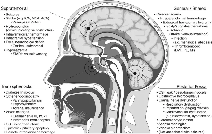 Post-TBI Complications by Location