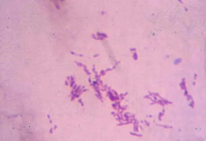 Mycobacterium leprae in a slit skin smear