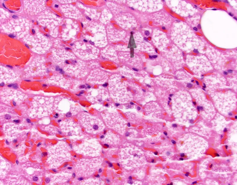 Histology of brown adipose tissue