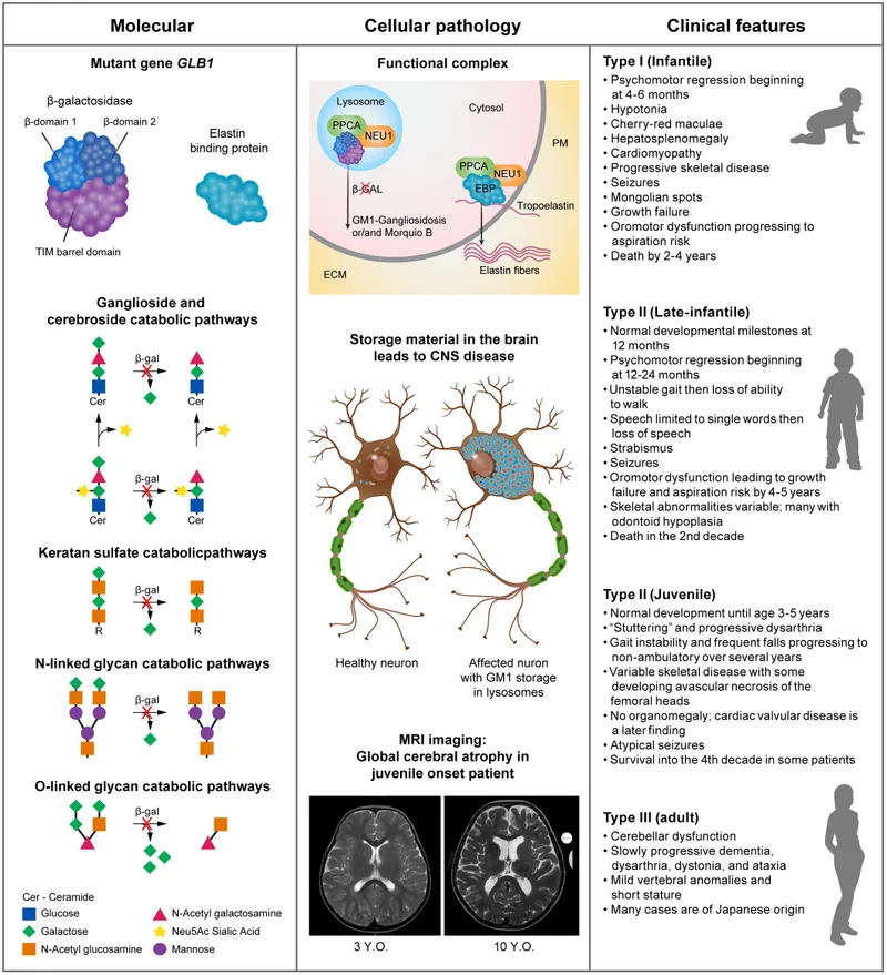GM1-Gangliosidosis: Molecular, Cellular, and Clinical