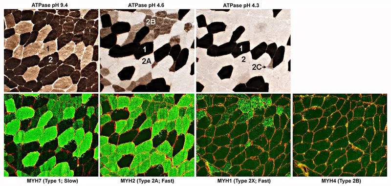 Muscle Fiber Types by ATPase and Myosin Heavy Chain