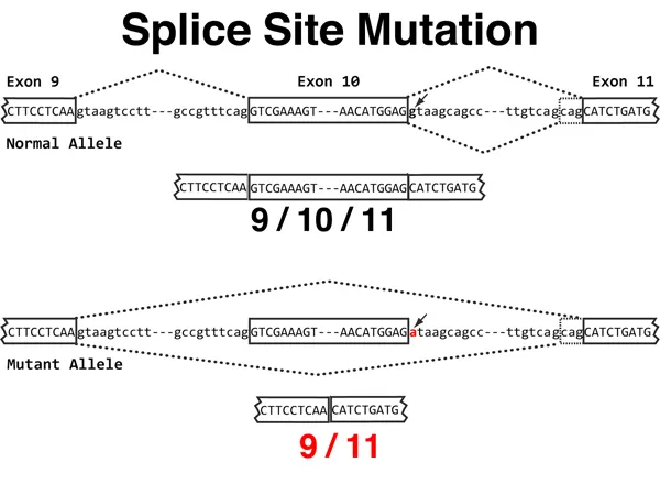 Splice Site Mutation: Exon Skipping