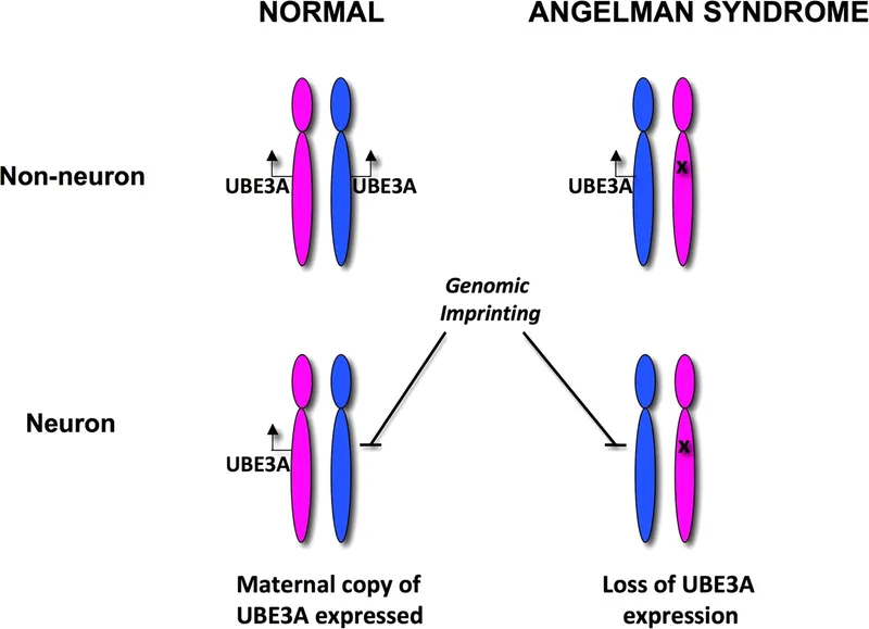 Genomic Imprinting and UBE3A Expression in Angelman Syndrome