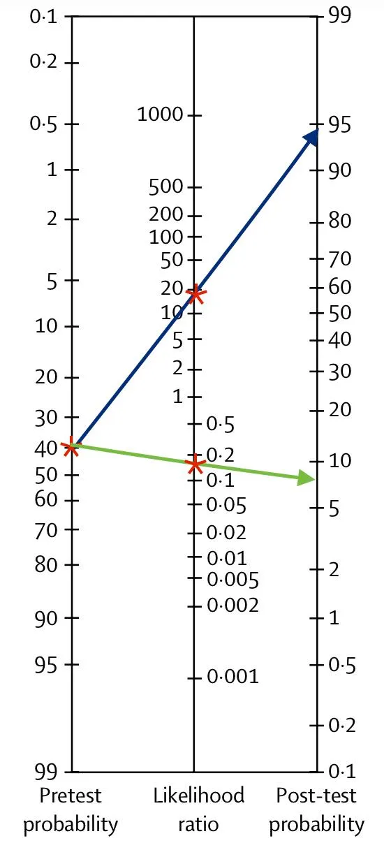 Fagan's Nomogram for Pre-test and Post-test Probability