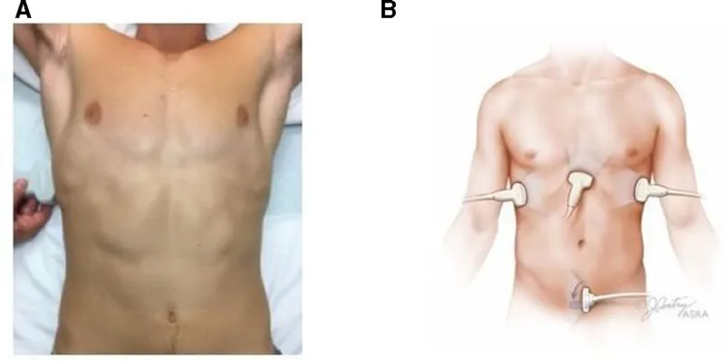 FAST exam windows and probe placement