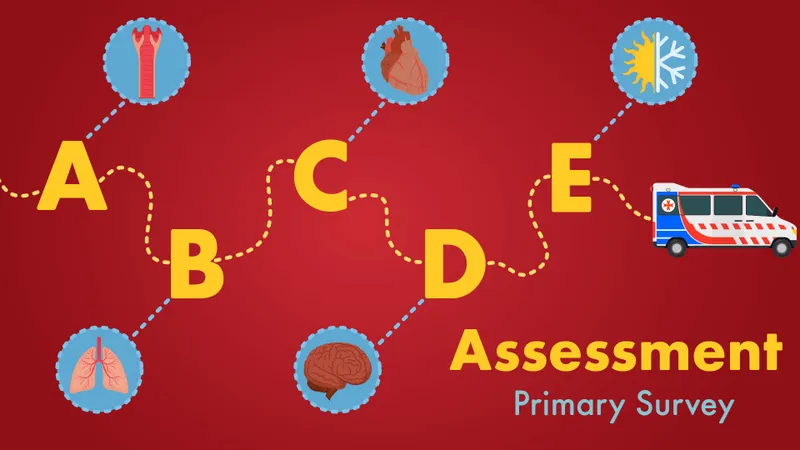 ABCDE Primary Survey for Emergency Assessment