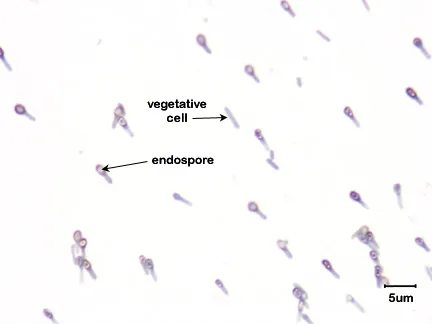 Clostridium tetani with vegetative cells and endospores