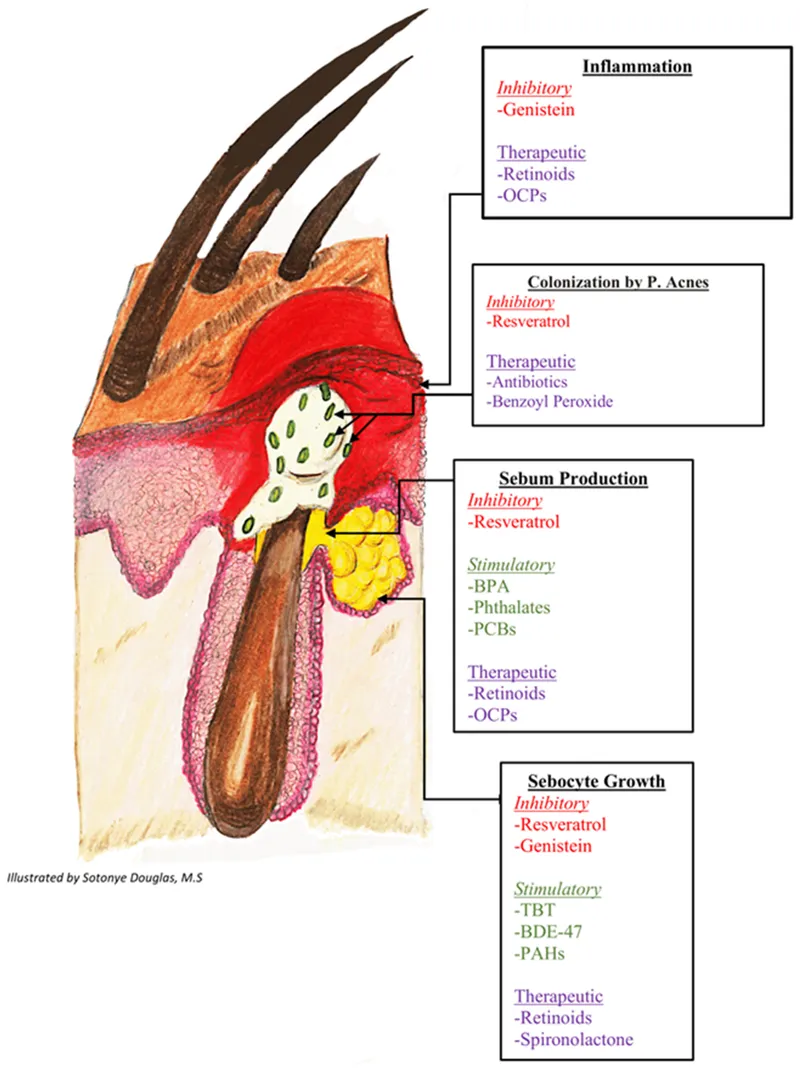 Factors influencing sebaceous gland activity and acne