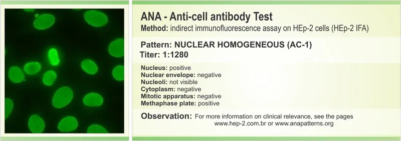 ANA Nuclear Homogeneous Pattern (AC-1) on HEp-2 cells