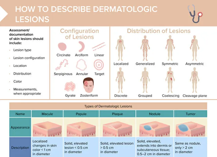 Dermatologic Lesion Description Guide
