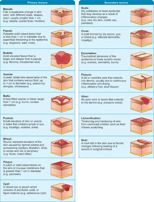 Primary and Secondary Skin Lesions Diagram