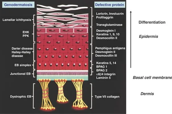Skin layers and defective proteins in blistering diseases