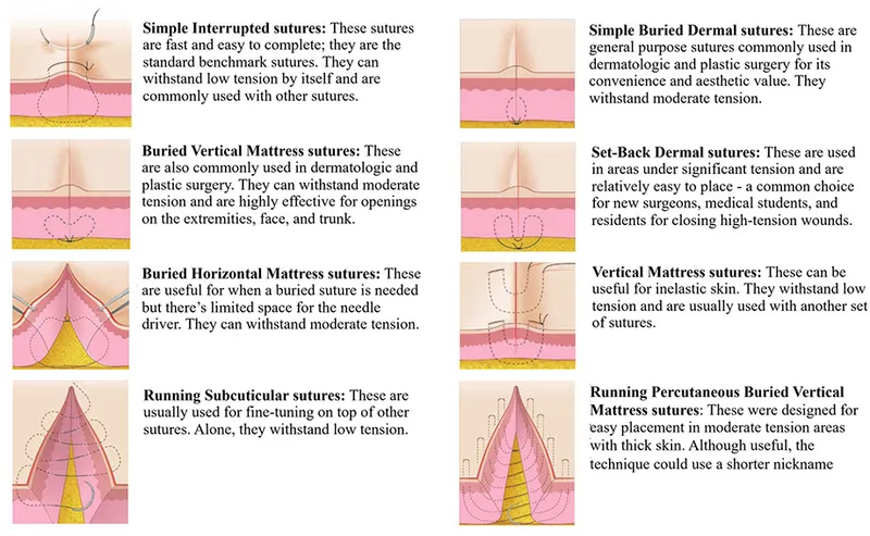 Common Suturing Techniques
