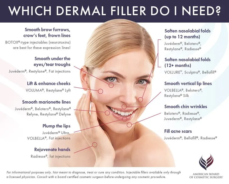 Dermal filler types and injection areas
