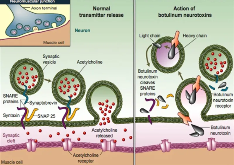 Botulinum toxin mechanism at neuromuscular junction