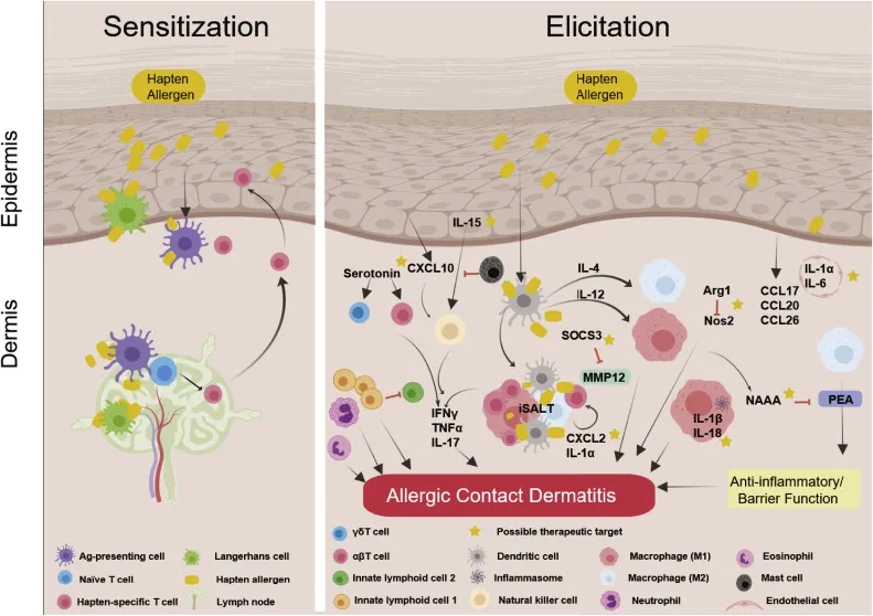 Allergic Contact Dermatitis Pathophysiology Diagram