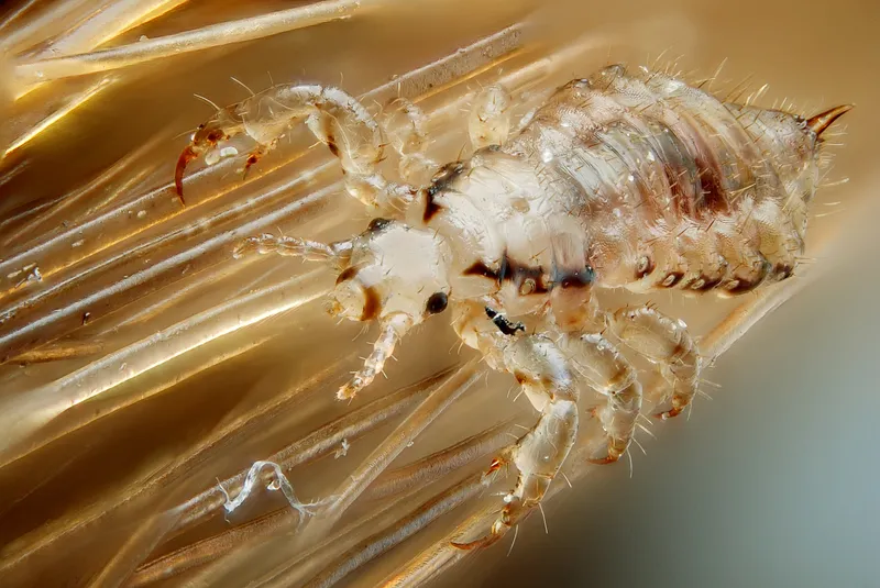 Head louse and nits on hair shaft