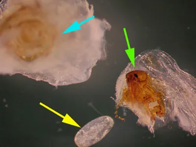 Tunga penetrans adult flea, egg, and abdominal segment