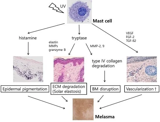 Melasma pathogenesis diagram