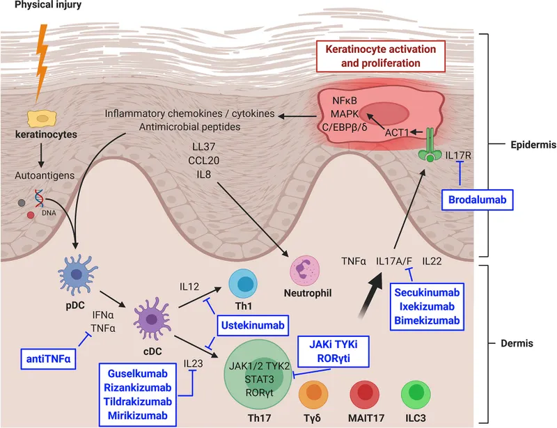 Psoriasis Pathophysiology and Treatment Targets