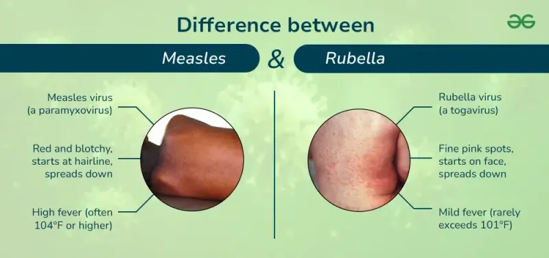Measles vs Rubella Rash Comparison
