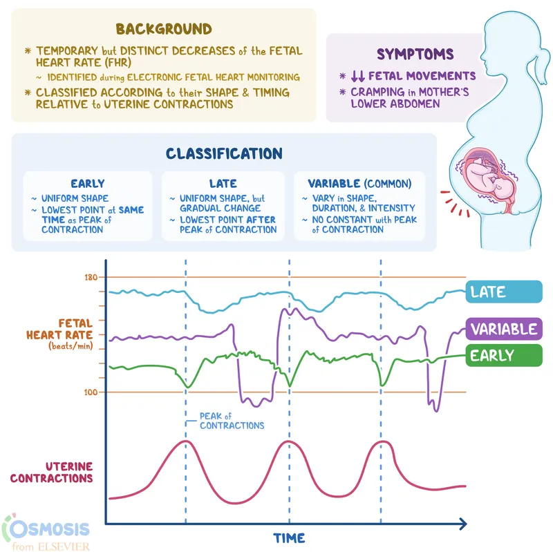 Fetal Heart Rate Decelerations: Early, Late, Variable