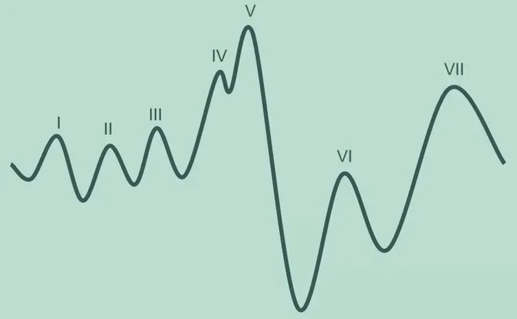 ABR waveform with labeled waves I-VII