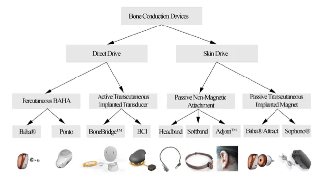 Bone Conduction Devices Classification