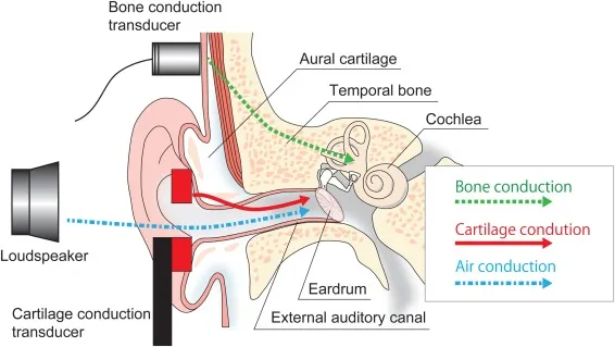 Hearing Pathways: Air, Bone, Cartilage Conduction