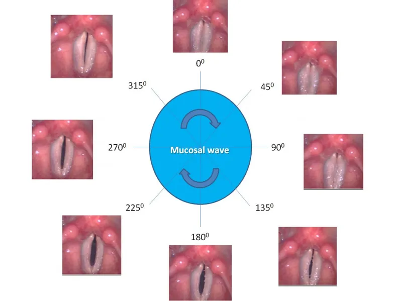 Vocal fold mucosal wave in vibratory cycle
