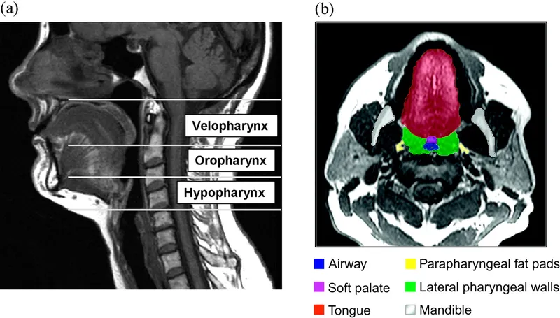 Upper airway anatomy in sagittal and axial views
