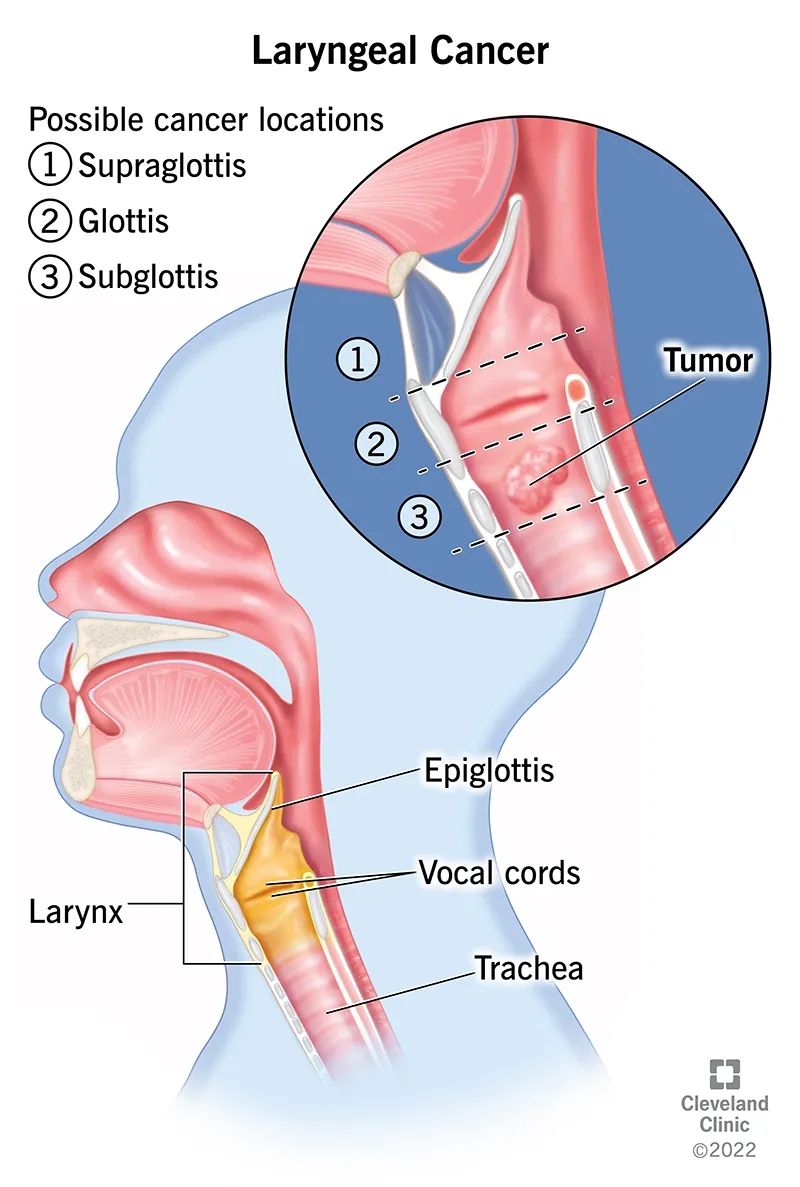 Larynx anatomy with supraglottis, glottis, subglottis