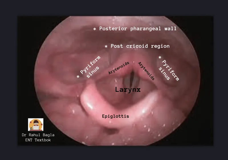 Endoscopic view of normal laryngeal anatomy