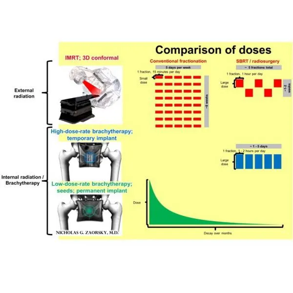Radiation Therapy Doses and Techniques