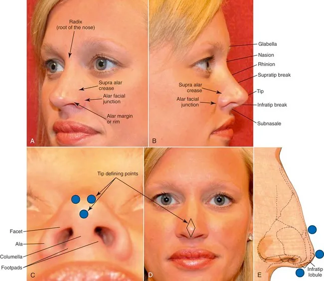 Nasal aesthetic subunits and anatomical landmarks