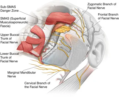 SMAS layers and facial nerve danger zones in facelift