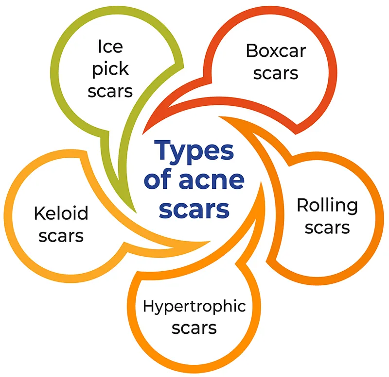 Diagram of skin layers and scar formation