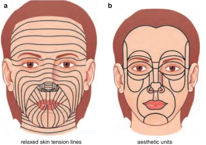Facial aesthetic subunits and relaxed skin tension lines