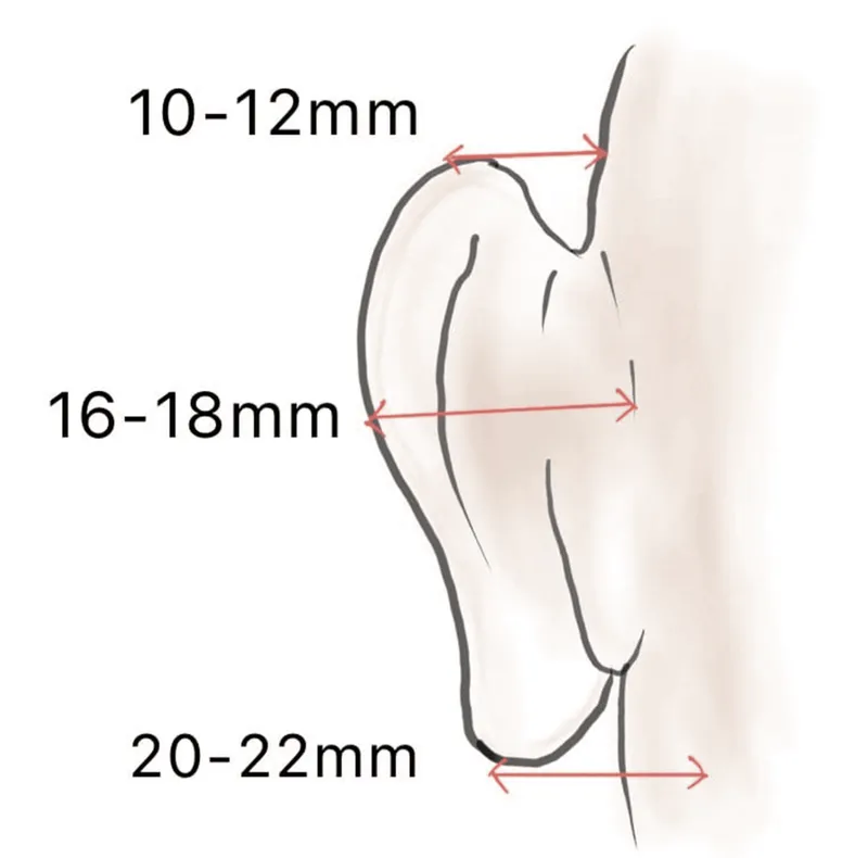 Normal Ear Anatomy with Ideal Otoplasty Angles