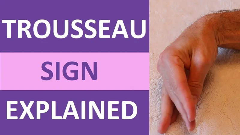 Trousseau sign clinical demonstration