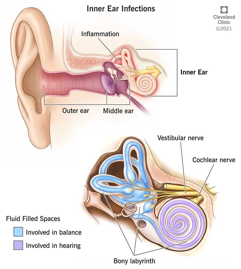 Inner ear anatomy and inflammation