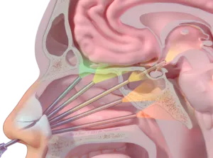 Endoscopic Endonasal Approach to Skull Base